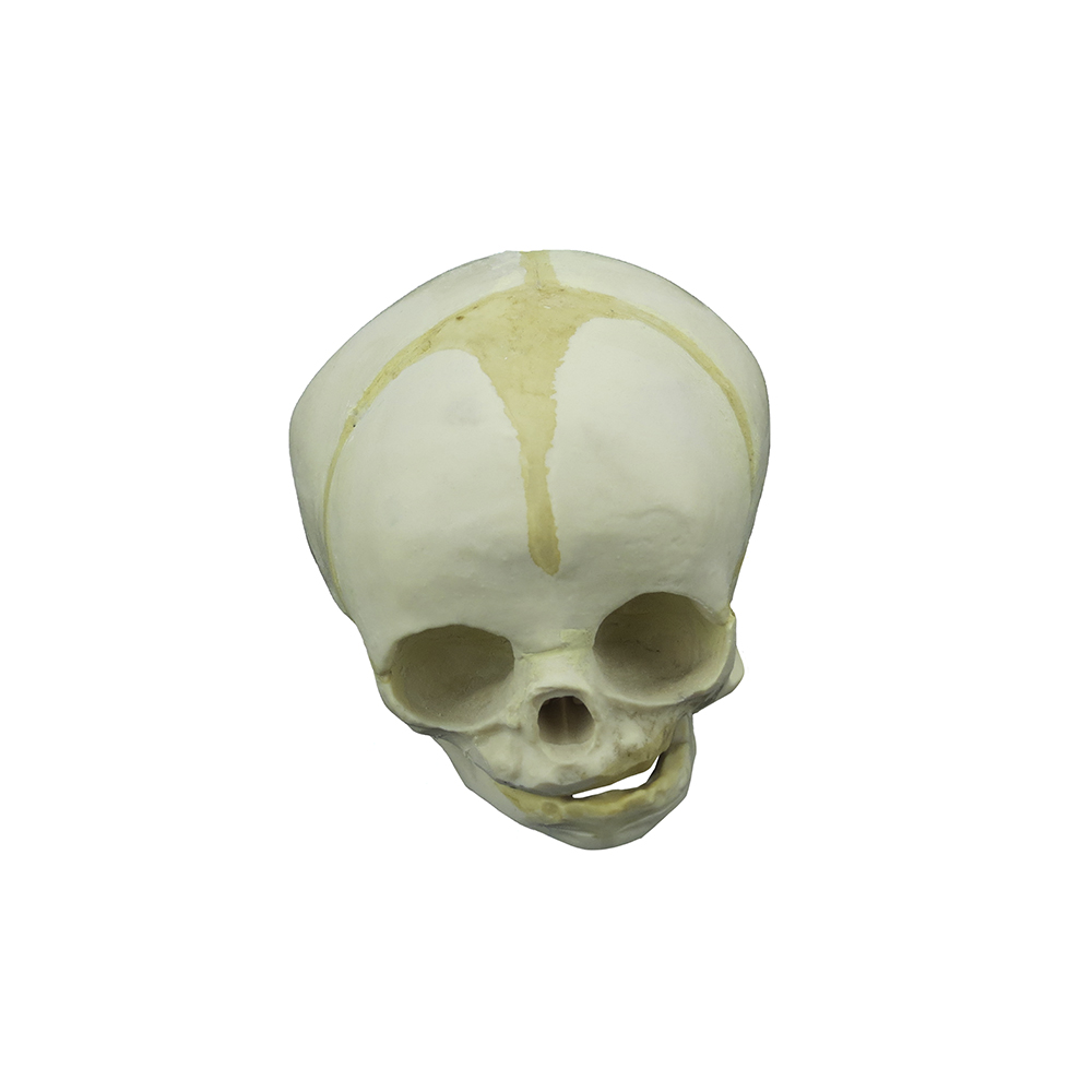 CRÂNIO HUMANO FETAL