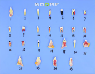 MODELO DE PATOLOGIAS DENTÁRIAS  25 PARTES EM PLACA