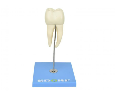 DENTE MOLAR INFERIOR C RAIZ DUPLA EM 3 PARTES C CÁRIE, 8X O TAMANHO REAL APROX.