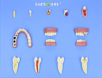 MODELO DE PATOLOGIAS DENTÁRIAS C 12 PARTES EM PLACA
