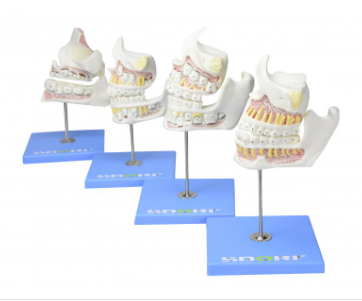DESENVOLVIMENTO DA DENTIÇÃO EM 4 ETAPAS