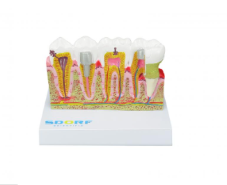 MODELO DE PATOLOGIAS DENTÁRIAS