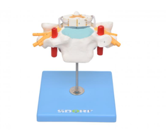 VÉRTEBRA CERVICAL C CORDÃO ESPINHAL